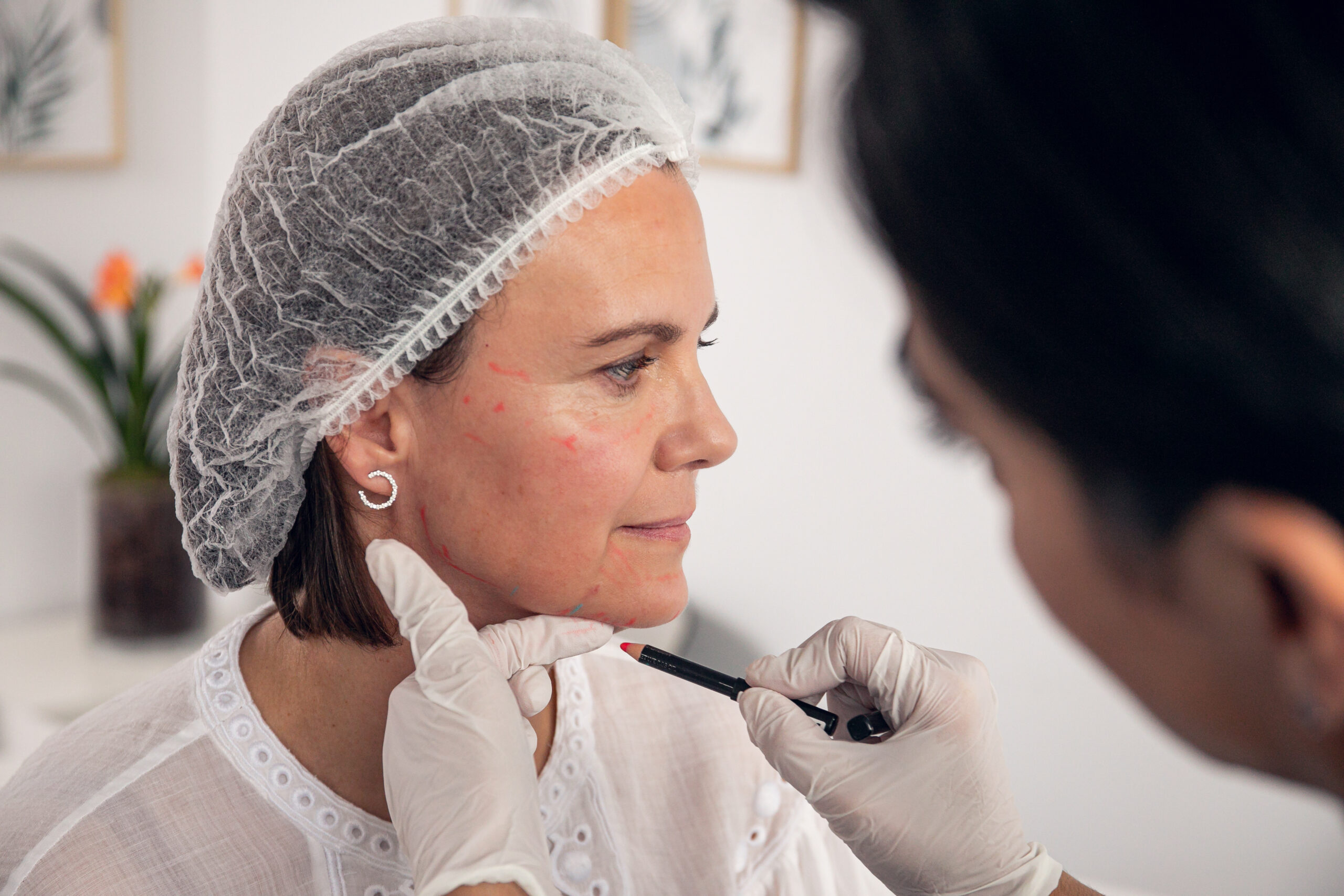 Armonización Y Rejuvenecimiento Facial - Clínica +Cueto