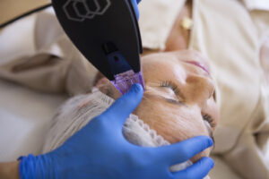 Morpheus. Definición Del Óvalo Facial, Firmeza Y Rejuvenecimiento 5 Morpheus. Definición Del Óvalo Facial, Firmeza Y Rejuvenecimiento 24 - Clínica +Cueto